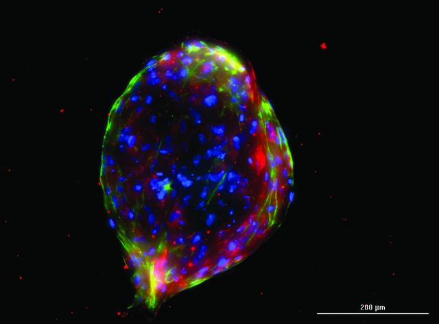 Final z-projected image of chondrocyte differentiated human mesenchymal stem cell 3D spheroid